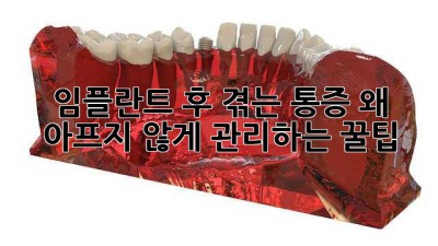 임플란트 후 겪는 통증, 왜? 🤔 아프지 않게 관리하는 꿀팁🍯